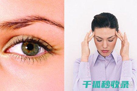 眼疲劳